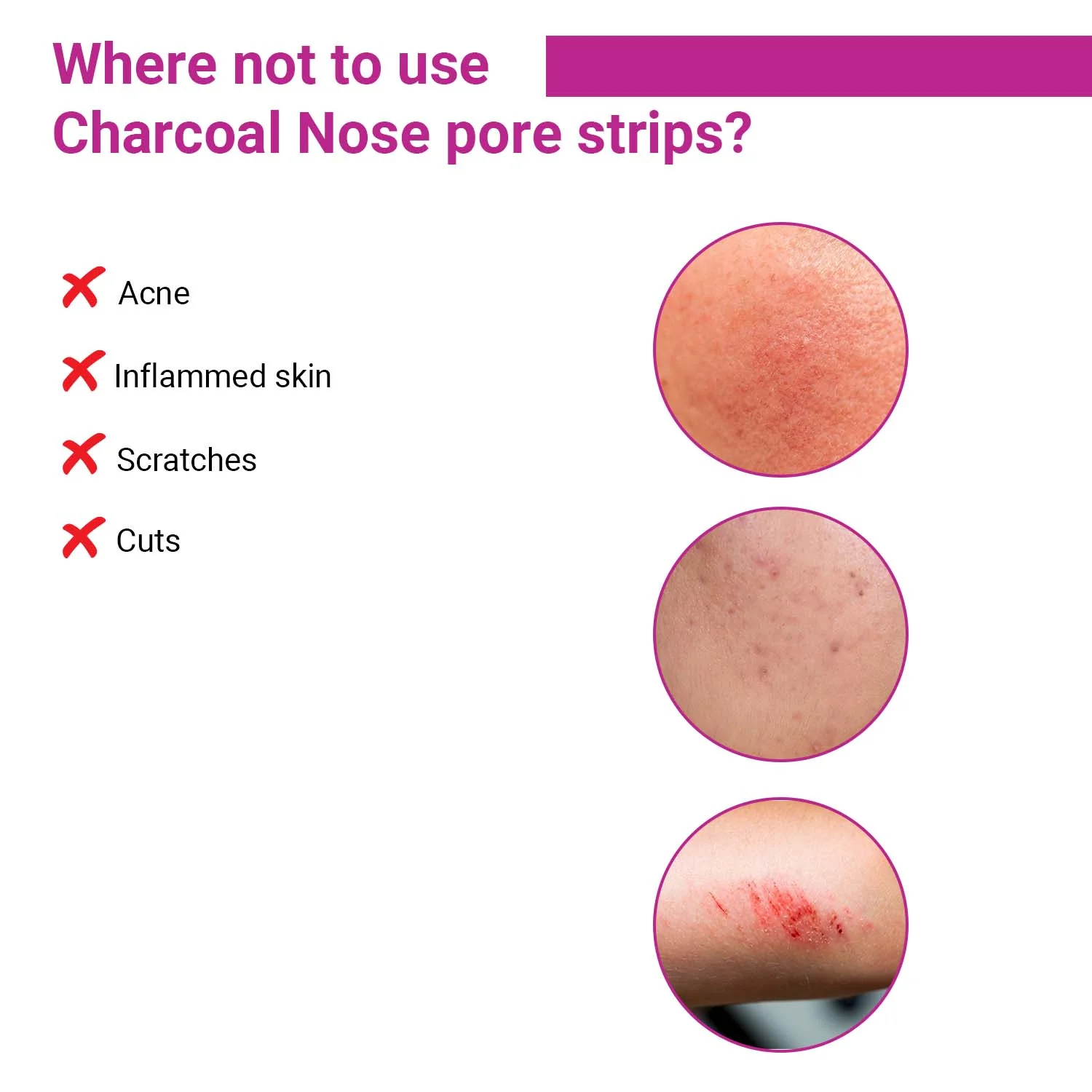 Charcoal Nose Pore Strips | Deep Cleansing - Image 6