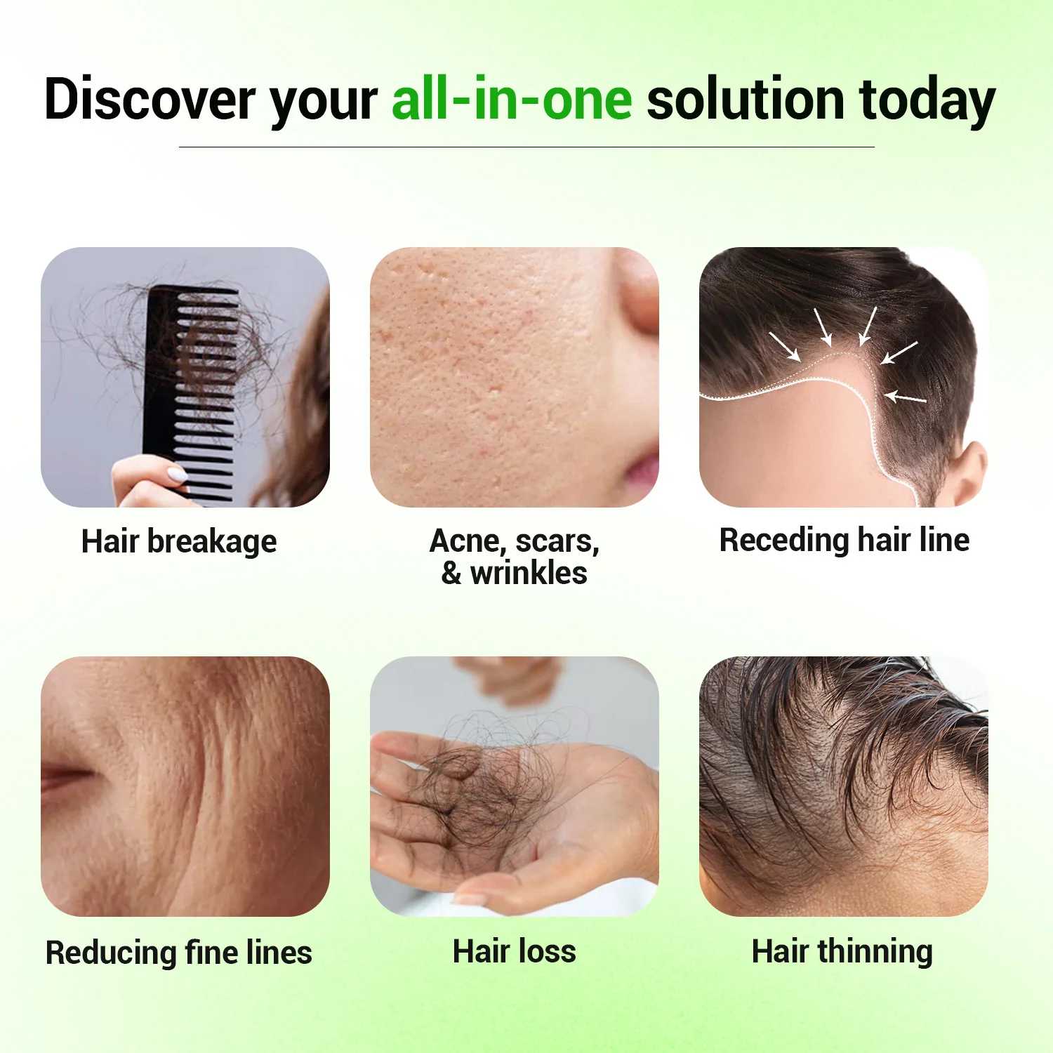 Epifine Derma Roller (0.5mm) | Microneedling - Image 6