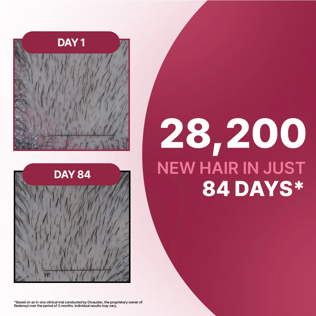 Hair Growth Serum | 12% Hair Growth Actives - Image 3