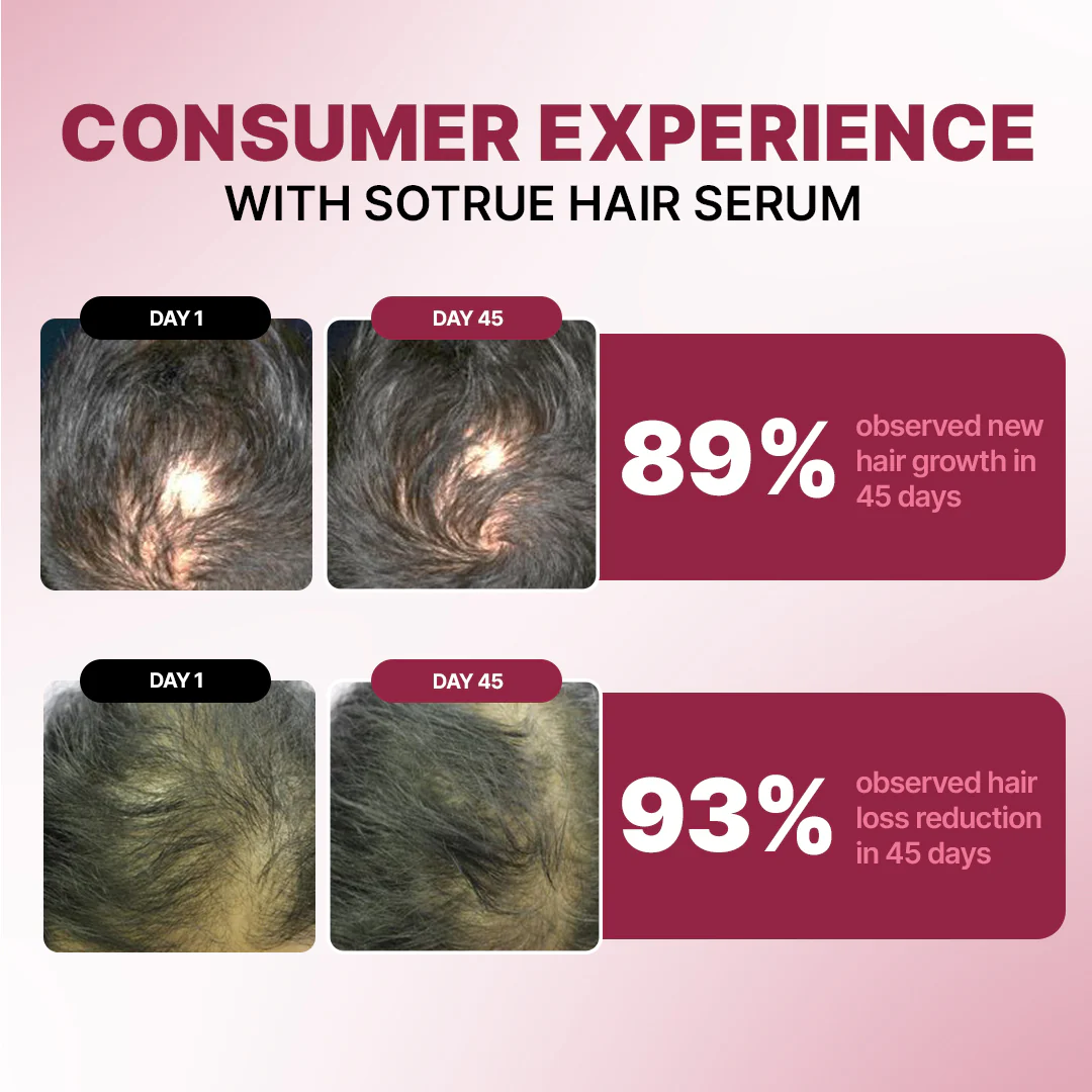 Hair Growth Serum | 12% Hair Growth Actives - Image 4