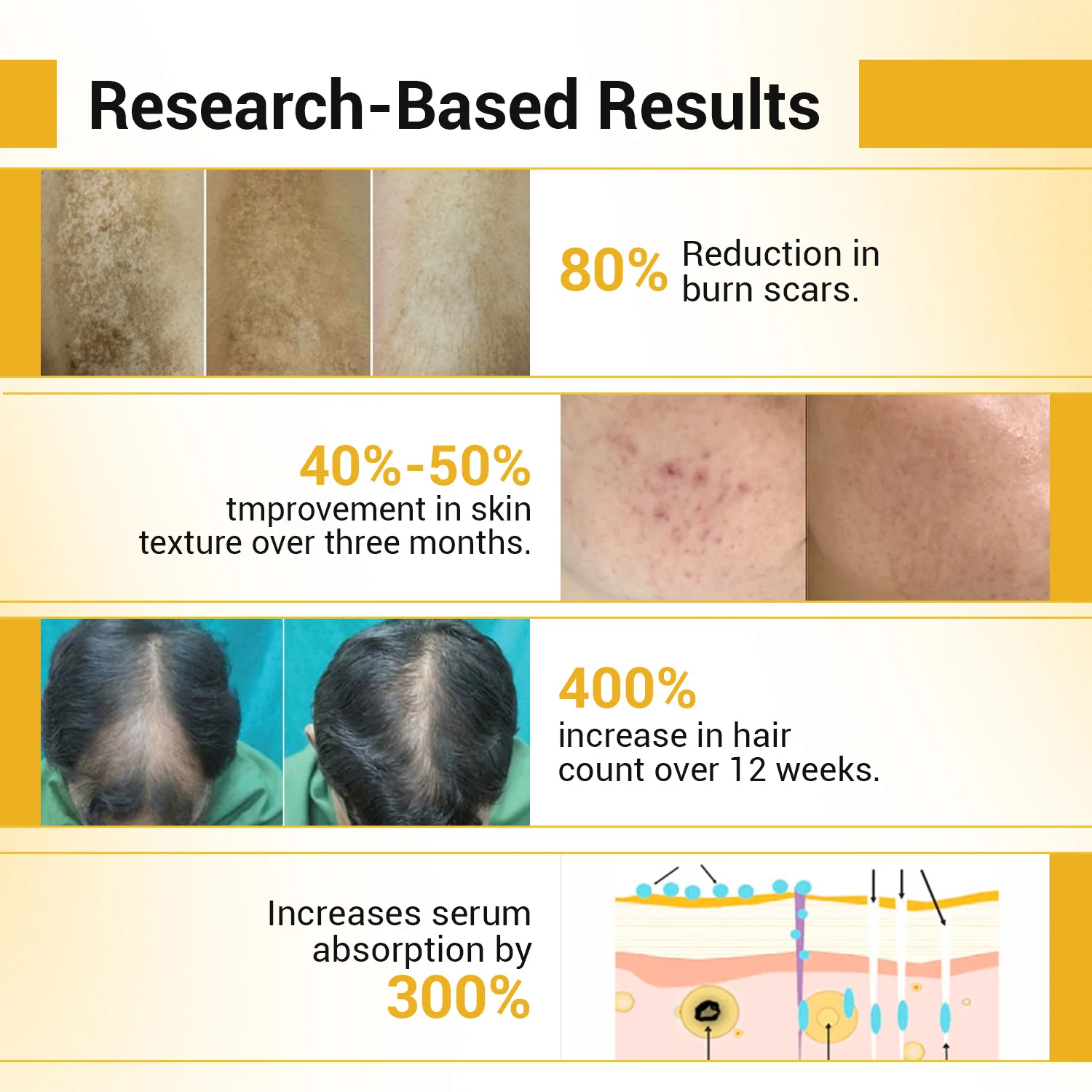Derma Roller Professional 1mm | For Hair & Skin - Image 3